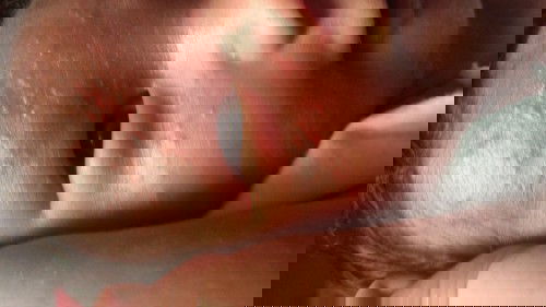 Any advice sa rashes nya po