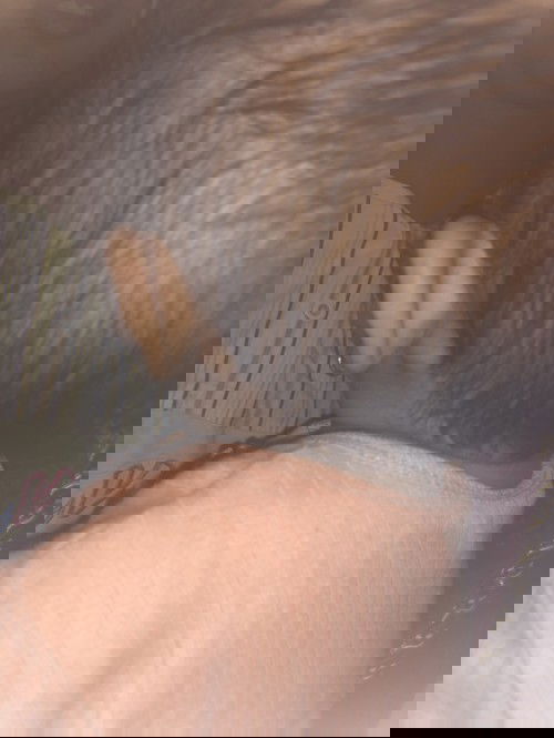 Benjolan di belakang telinga