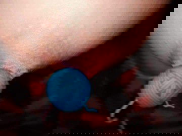 ลูกกัดนมเป็นแผล