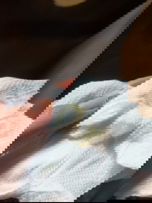 เเบบนี้มูกใส่หรือตกขาวค่ะ  ท้อง40+6 วีคค่ะ