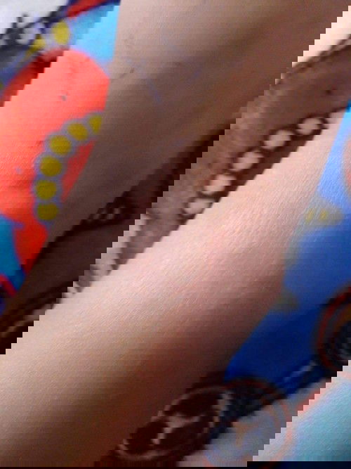 ขอคำแนะนำคุณแม่สมาชิกทุกบ้าน สำหรับครีมทาผิวหนังแห้ง สาก คัน ตามข้อพับ