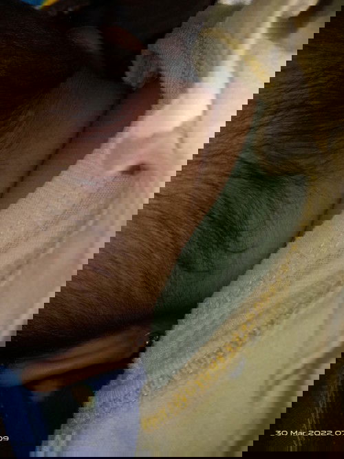 Merah dibelakang leher bayi