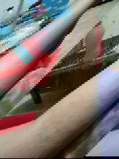 Gatal biduran saat hamil