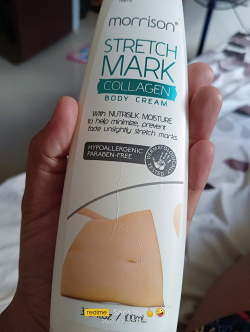 Morrison stretch mark.