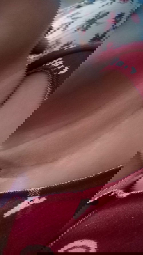 Bercak putih di kulit bayi