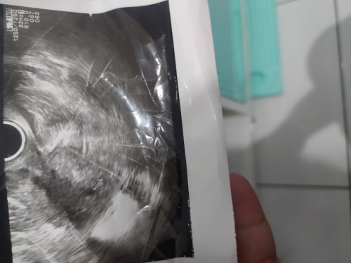 Kehamilan ke 2&hasil USG