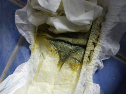 กังวนมากค่ะ