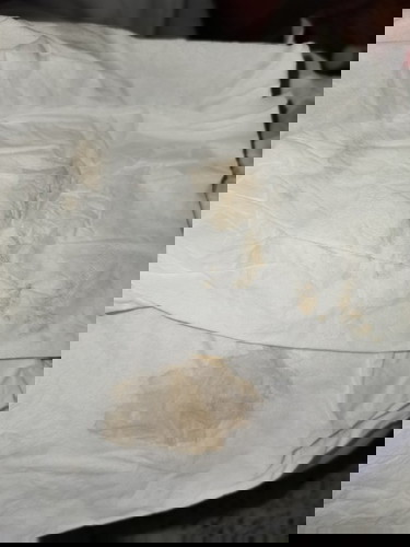 ประจำเดือนขาด4วัน