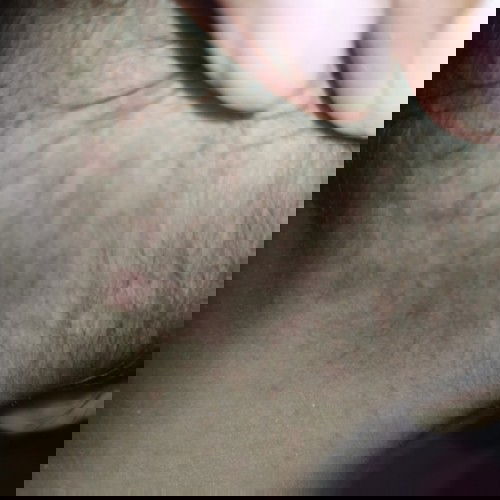 Merah didekat leher belakang