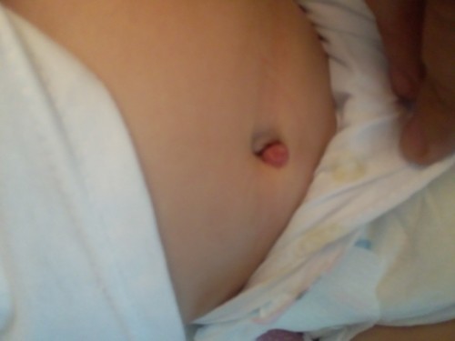 Help nmn po baka may makasagot po sa inyo.pero ipapacheck up ko na rin po si baby bukas.salamat po..