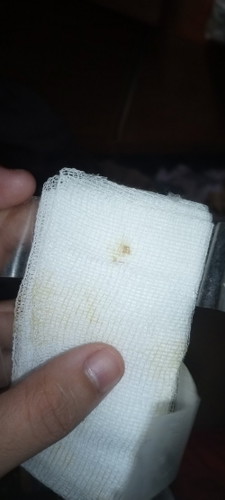FOR ECTOPIC PREGNANCY DONE SURGERY