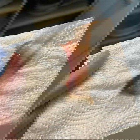 โดนกระตุ้นปากมดลูก 38+1week