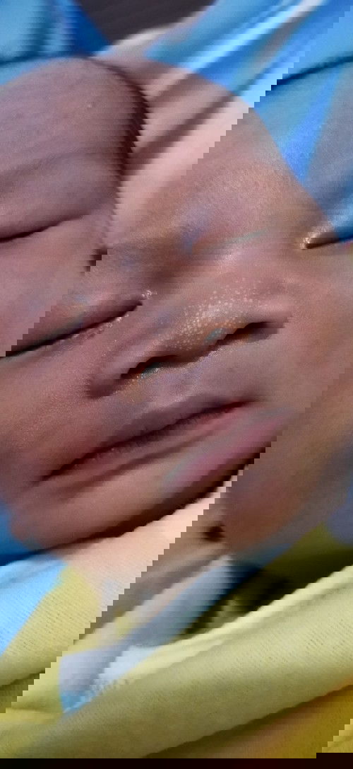 Kenapa dengan hidung