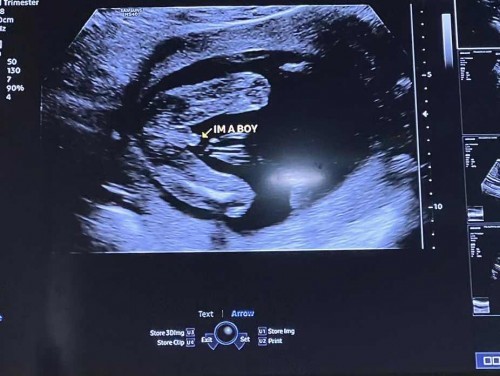 Scan bb boy