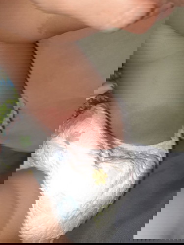 ลูก1ขวบยืดตัวถ่ายท้องไข้ขึ้น