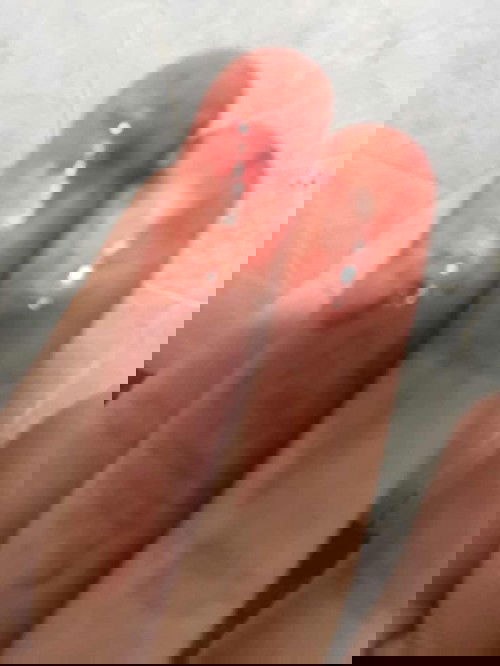 แท้งแล้ว หรือ น้องยังอยู่