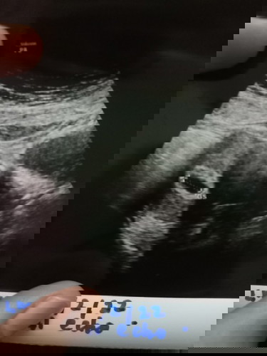 Nak tanya..normal ka kantung MCM nie