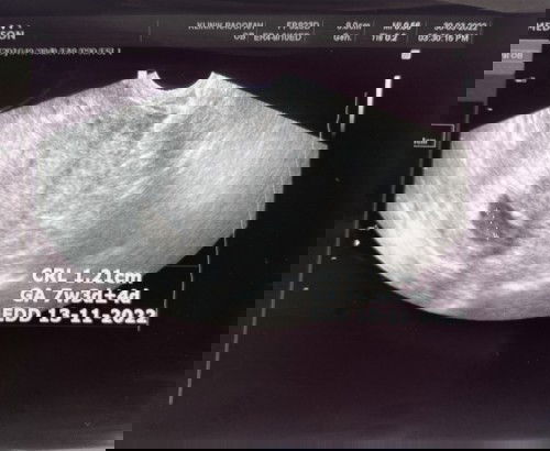 Alhamdulillah syukur ya Rabb 🤲🏻😭 sedih sangat saya rasa 😔