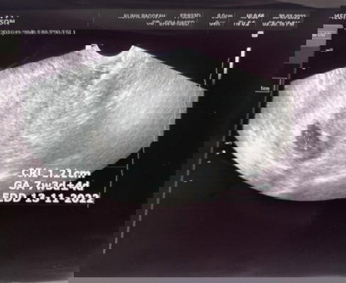 Alhamdulillah syukur ya Rabb 🤲🏻😭 sedih sangat saya rasa 😔