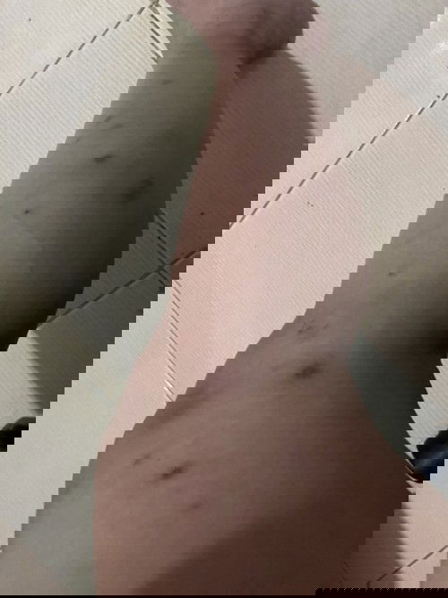 Peklat during pregnancy