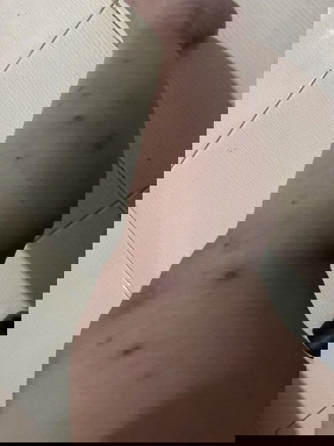 Peklat during pregnancy