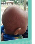 Kepala belakang bayi agak kedalem