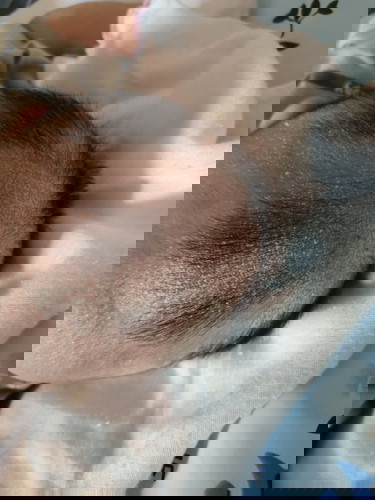 ลูก 2 เดือน 25 วัน หนังหัวแห้งมาก มีบ้านไหนเป็นบ้างคะ