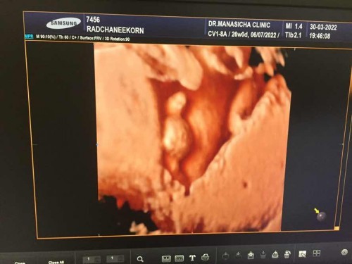 26+1 ทีม กรกฎาคมค่ะ ลูกเสือน้อย