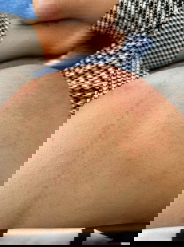 คุณแม่คนไหนเคยเป็นแบบนี้บ้างคะ