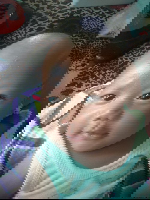 ผื่นที่หน้าผาก ใช้อะไรหาย