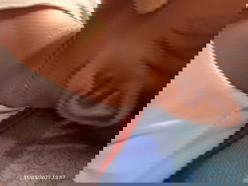 Bintik bintik di leher bayi 2 bulan