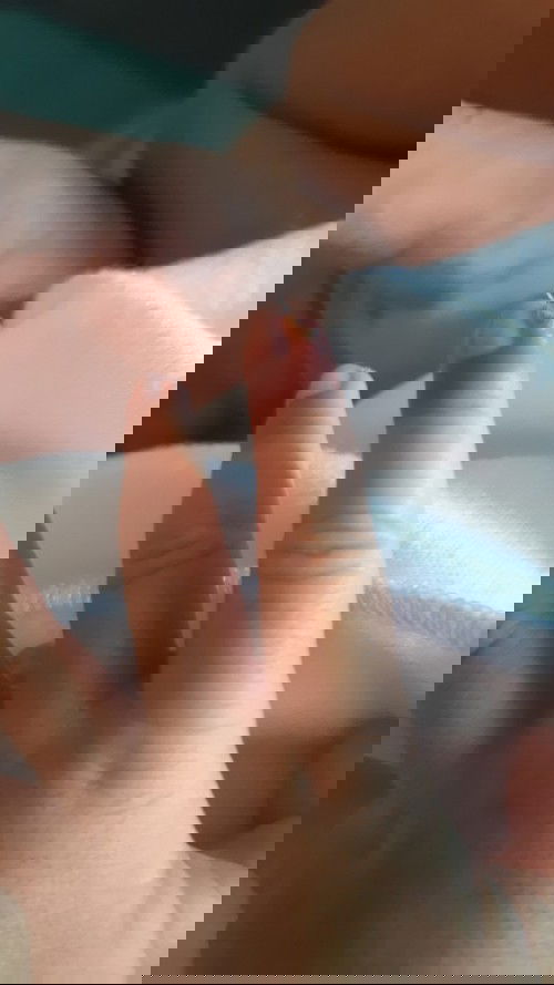 Jari bayi seperti terkelupas