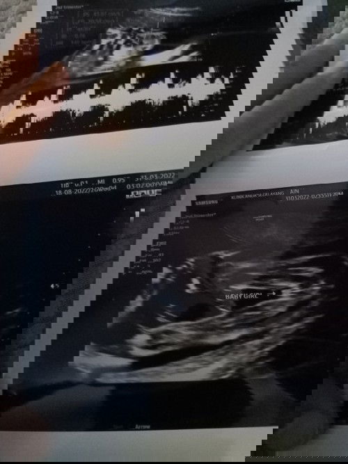 20 minggu buat details scan alhamdulillah dapat baby girl. Semoga membesar dengan sihat dan sempurna