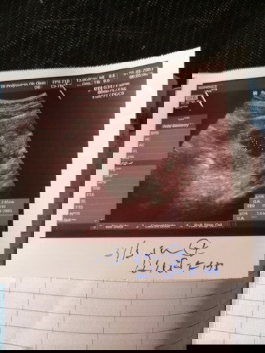 ขอความเห็นหน่อยค่ะ