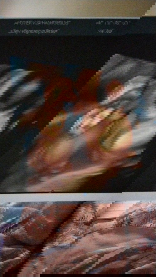 HPL HPHT berbeda jauh dengan HPL USG