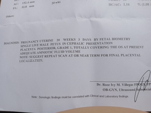 Buntis po Ako 5months na