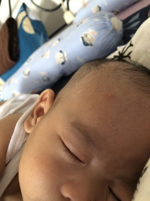 Right side flat head?