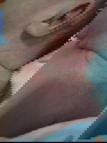 คุณแม่ใช้ครีมอะไรทาให้ลูกๆกันคะ