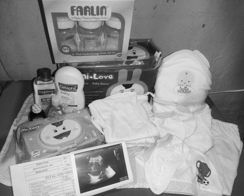 happy to share (posterior previa to anterior high lying)