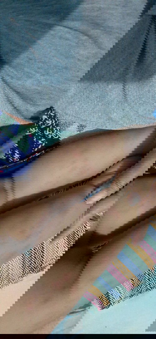 Mau tanya bun... ada yg pernah mengalami tangan dan kaki si kecil muncul bintik kemerahan?