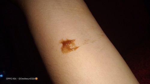 Keluar flek trus menerus konpal