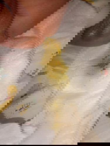 ปัญหาลูกอึ