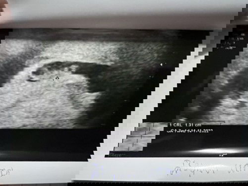 เจอน้อง พร้อมหัวใจเต้นแล้ว