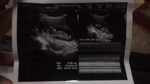 PA HELP PO MGA MOMMIES ASKING LNG PO.