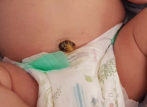 สายสะดือลูกกี่วันหลุดคะ?