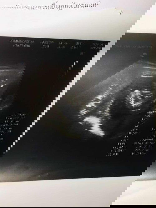 มีแม่ๆคนไหนมองออกบ้างค่ะว่า ผู้หญิงหรือผู้ชาย