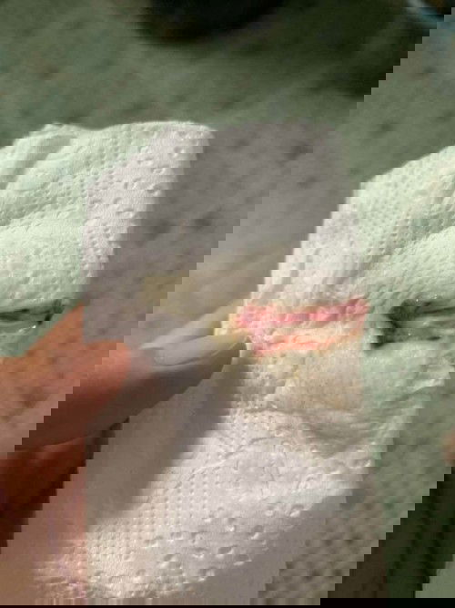 สอบถามแม่ๆหน่อยค่ะ ท้องได้ 30 สัปดาห์ แล้วมีเลือดออกแบบนี้ปกติไหมคะ รกปกติ โทรถามหมอแล้วหมอว่าปกติ แต่เราไม่สบายใจเลย