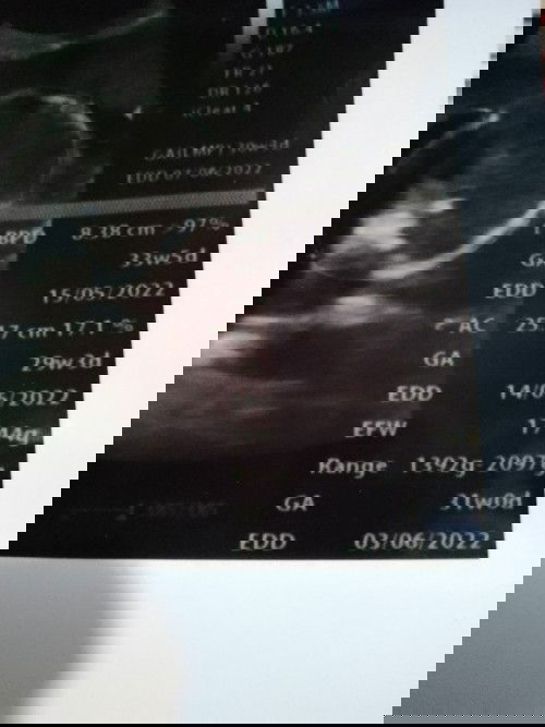 Baca hasil USG dan perkiraan UK