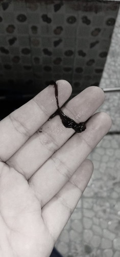 กังวลมาก เลือดออกเป็นลิ่มๆ