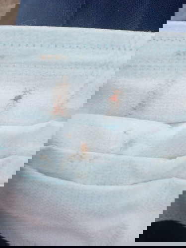 มีมูกปนเลือดแบบนี้
เป็นอันตรายอะไร
ไหมค่ะปวดท้องน้อยด้วยค่ะ
ท้อง8วิก ขอถามผู้รู้ค่ะ
#ขอคำแนะนำหน